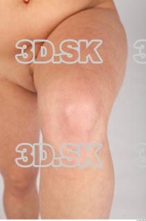 Knee texture of Casey 0002